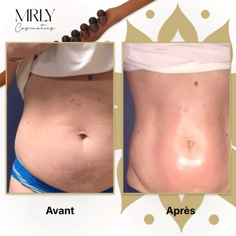 MRLY™ Barre de Drainage Lymphatique en Bois