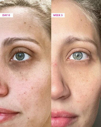 Sérum pour les yeux 8 en 1 - collagène et rétinol