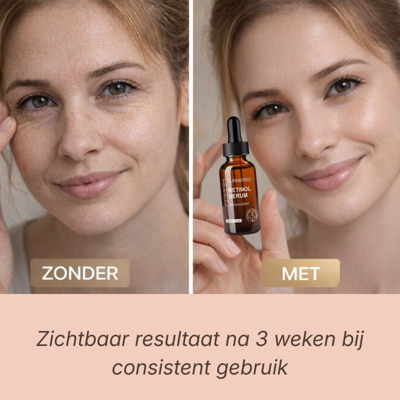 Retinol serum - lift en verstevigt de huid